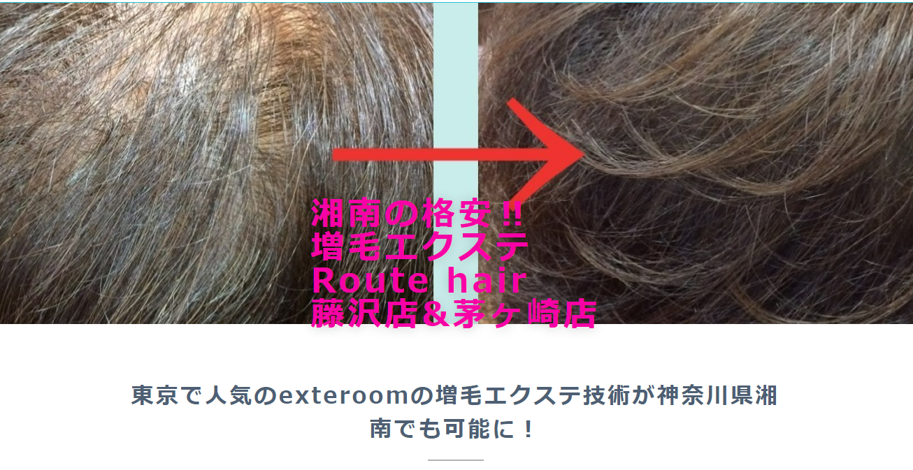 増毛Route hair公式サイトのキャプチャ.png